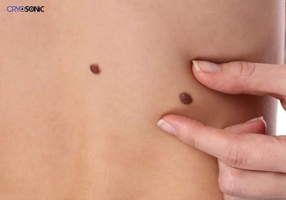 Infection Risk and Poor Aftercare Stevenage