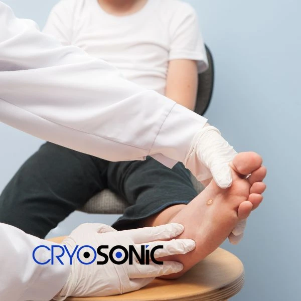 Are you looking for fast effective wart removal Contact us today Stevenage